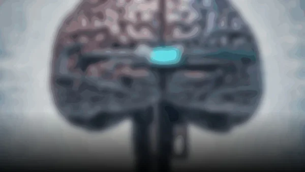 Revolución en la neurotecnología: Science Corp. inicia ensayos humanos para un sensor cerebral innovador